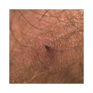 Karta do usuwania kleszczy Lifesystems Tick Remover Card